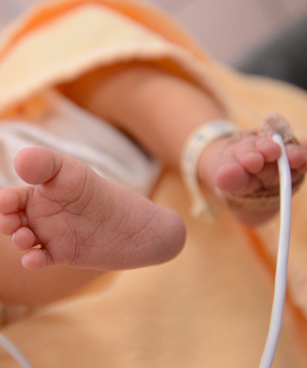 newborn infant with monitor around foot